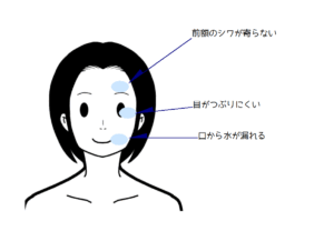 顔面の図（症状）